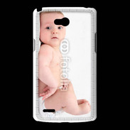 Coque LG L80 Bébé allongé sur le dos