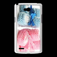 Coque LG L80 Chaussures bébé 3
