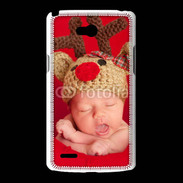 Coque LG L80 Bébé Rennes