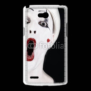 Coque LG L80 Clown 1