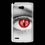 Coque LG L80 Œil de vampire