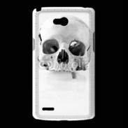 Coque LG L80 Crâne 2