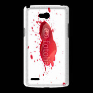 Coque LG L80 Sang 3
