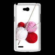 Coque LG L80 Tricot et couture