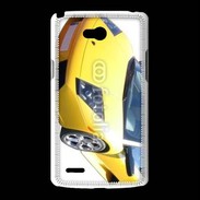 Coque LG L80 Muracielo