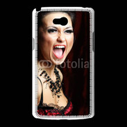 Coque LG L80 French Cancan 8