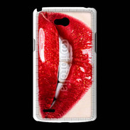 Coque LG L80 Belle bouche