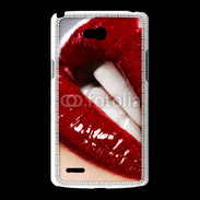 Coque LG L80 Bouche fatale rouge