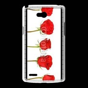 Coque LG L80 Rose en ligne 50