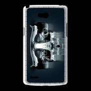 Coque LG L80 Formule 1 en dégradé