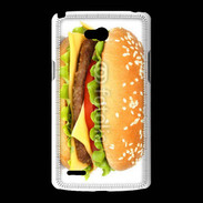 Coque LG L80 Hamburger