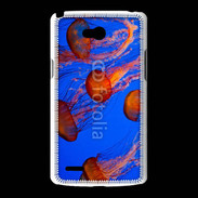 Coque LG L80 Bal de méduses