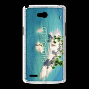 Coque LG L80 Atole