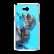 Coque LG L80 Duo de dauphins