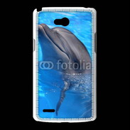 Coque LG L80 Dauphin 2