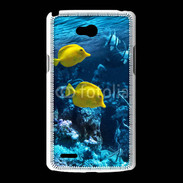 Coque LG L80 Poisson tropical