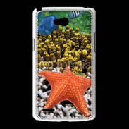 Coque LG L80 Etoile de mer