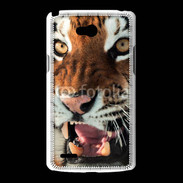 Coque LG L80 Tigre de Sibérie 1