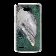 Coque LG L80 Tête de dauphin 1