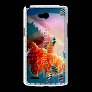 Coque LG L80 Méduse géante et poissons