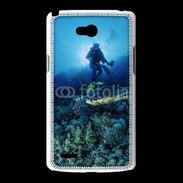 Coque LG L80 Tortue et plongeur
