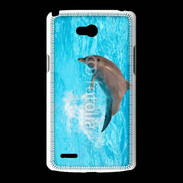 Coque LG L80 Dauphin 20