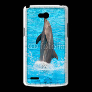 Coque LG L80 Spectacle de dauphin