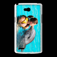 Coque LG L80 Bisou de dauphin