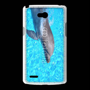 Coque LG L80 Dauphin 21