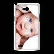 Coque LG L80 Bébé 2 