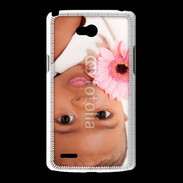 Coque LG L80 Bébé 5