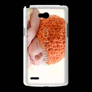 Coque LG L80 Bébé 7