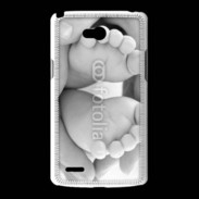 Coque LG L80 Pieds de bébé noir et blanc