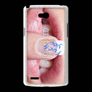 Coque LG L80 Fuck you 5