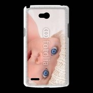 Coque LG L80 Humour de bébé 3