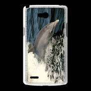 Coque LG L80 Coque Dauphin et vague