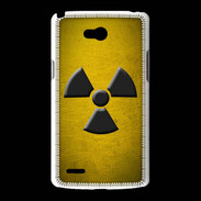 Coque LG L80 radioactif