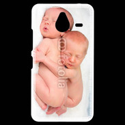 Coque Personnalisée Nokia Lumia 640XL LTE Duo de bébés qui dorment