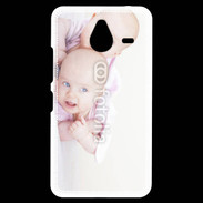 Coque Personnalisée Nokia Lumia 640XL LTE Jumelles 2