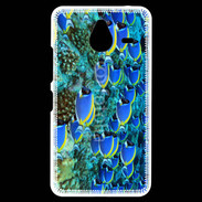 Coque Personnalisée Nokia Lumia 640XL LTE Banc de poissons bleus