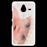 Coque Personnalisée Nokia Lumia 640XL LTE Humour de bébé 3
