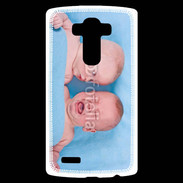 Coque Personnalisée Lg G4 Jumeaux 12