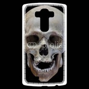 Coque Personnalisée Lg G4 Crâne