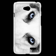 Coque LG L70 Husky hiver